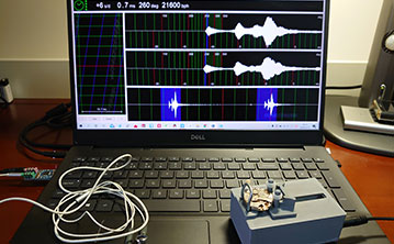 Sanmenxia HUBLOT Watch Demagnetization (Free of Charge) Sanmenxia HUBLOT Watch Demagnetization (Free of Charge)